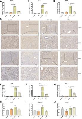 Macrophage malfunction in Triptolide-induced indirect hepatotoxicity